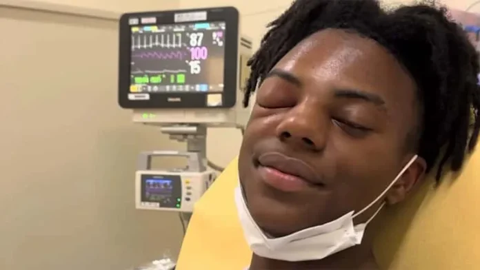 IShowSpeed undergoes eye surgery on March 13, 2025, addressing complications from his 2023 sinus infection. Fans rally behind the beloved streamer.